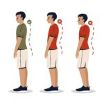 upper crossed syndrome